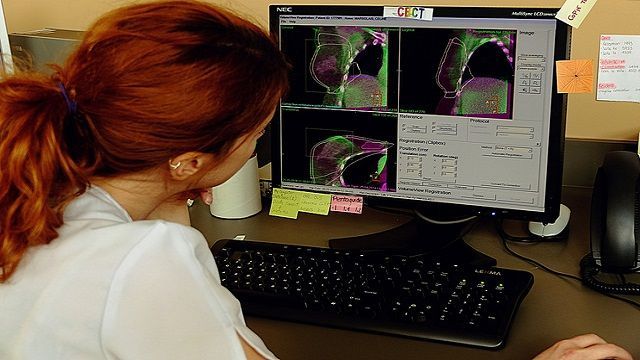 A Radiotherapy scan for a breast cancer patient: Photo from Flickr/Gerry Lauzon